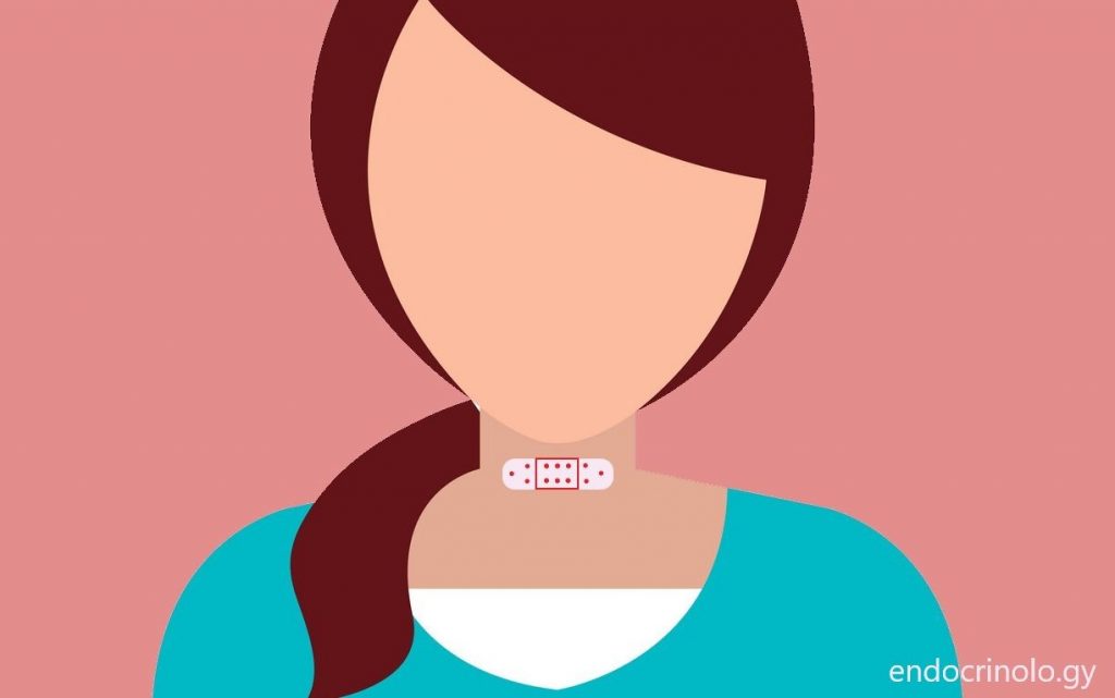 ნაწიბური