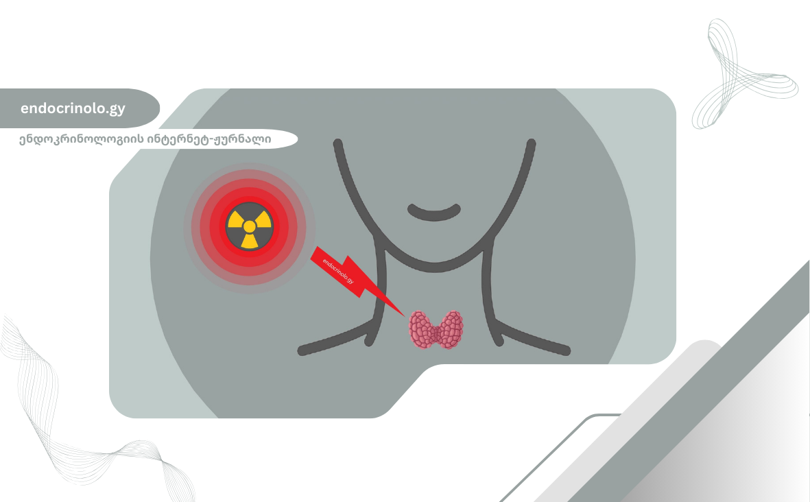 რადიოაქტიური იოდით თერაპია