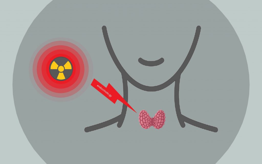 რადიოაქტიური იოდით თერაპია