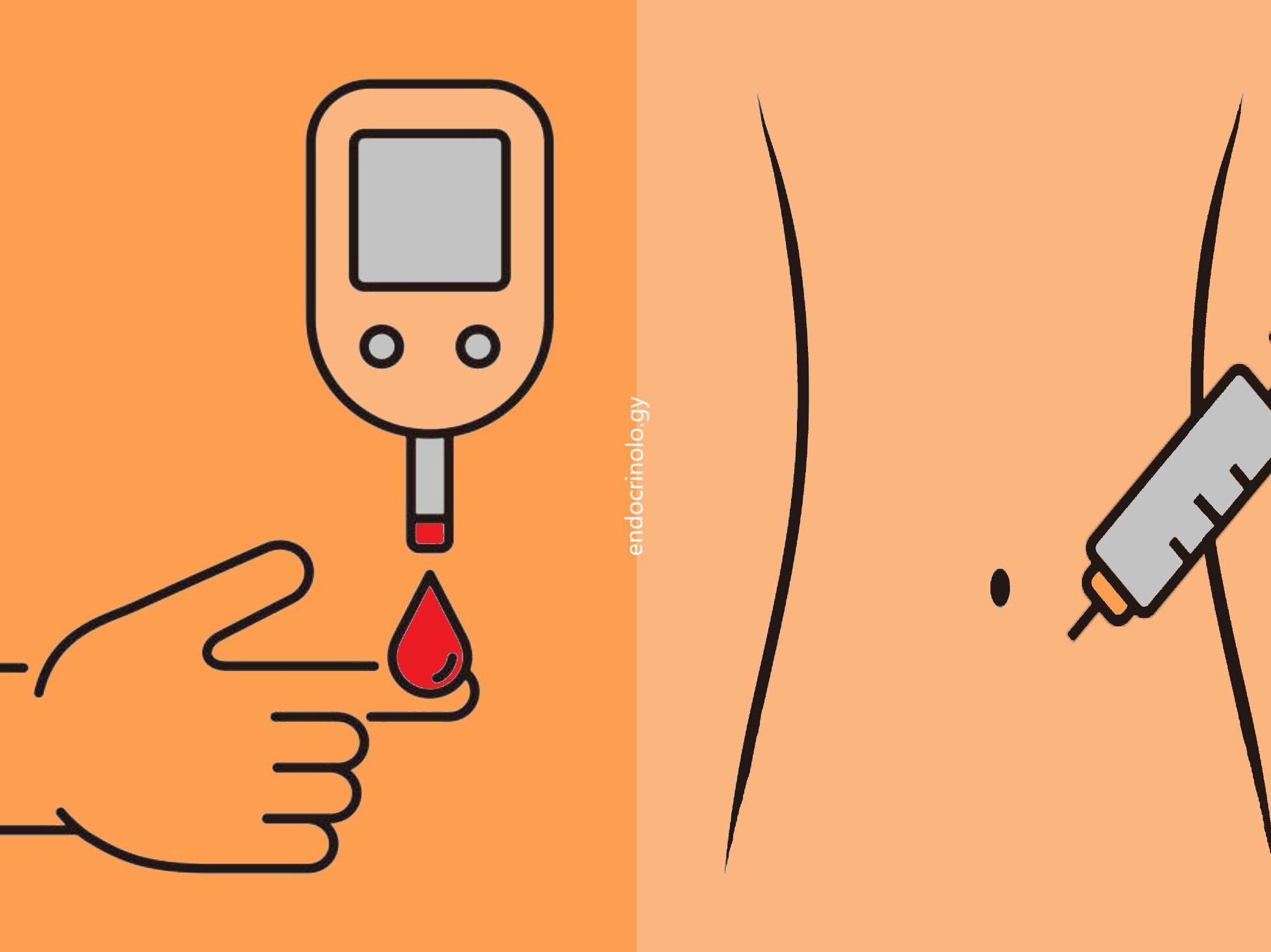 დიაბეტი ტიპი 1