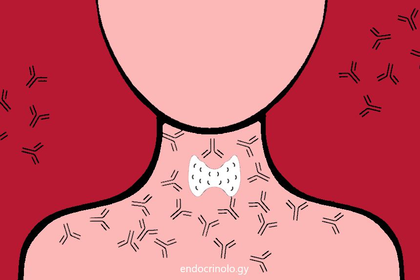 ფარისებრი ჯირკვლის ანტისხეულები